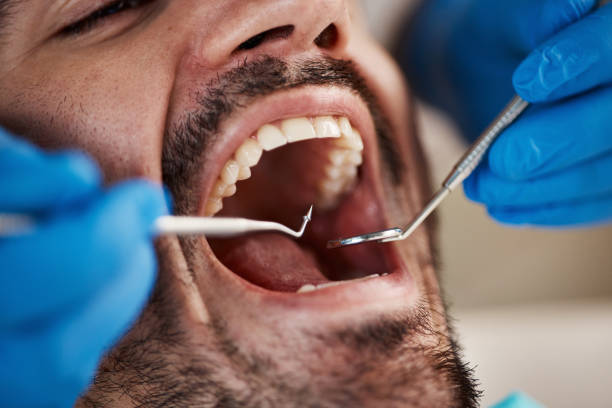 Best Cracked Tooth Emergency Dentist  in Brownstown, PA