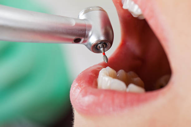 Best Tooth Infection Emergency Dentist  in Brownstown, PA